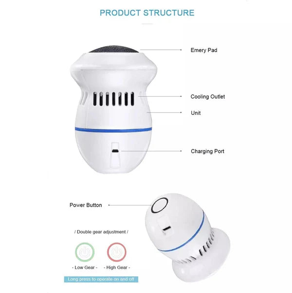 جهاز إزالة مسامير القدم الكهربائي Electric Callus Remover