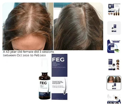 رذاذ نمو الشعر ⚡ Hair Growth Spray