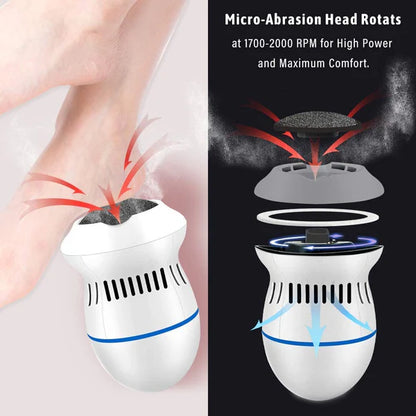 جهاز إزالة مسامير القدم الكهربائي   Electric Callus Remover